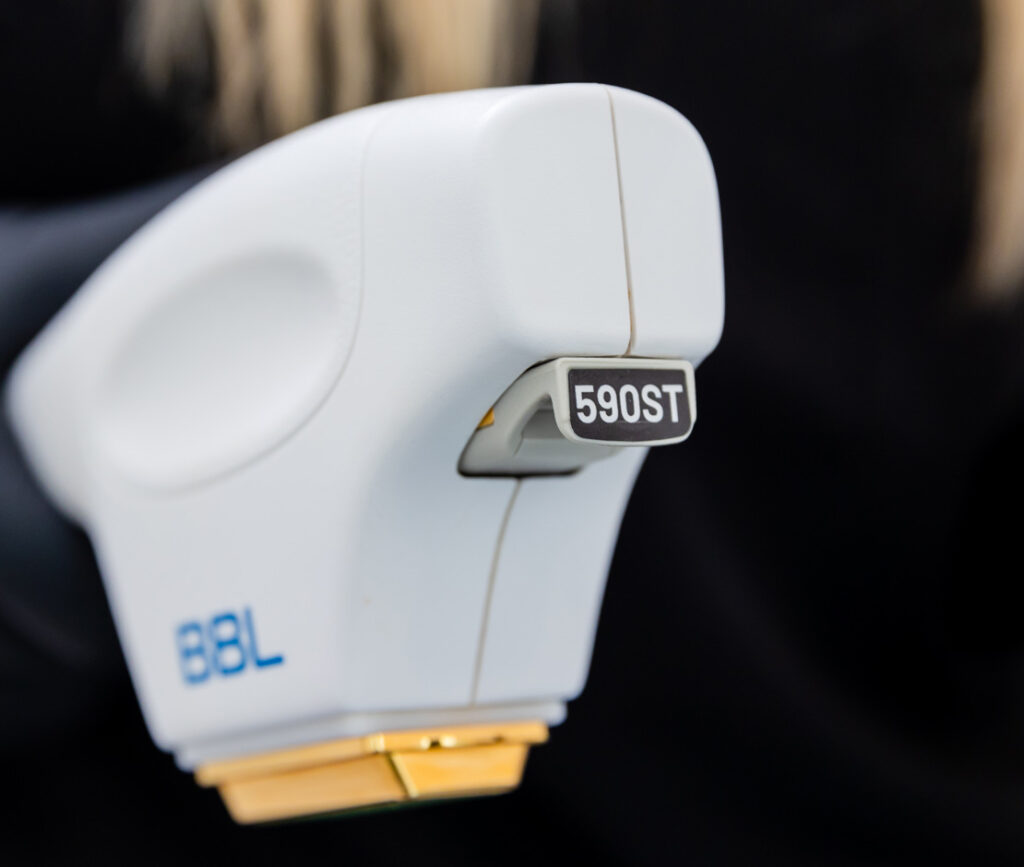 A close-up of the applicator for body sculpting near Cherry Hill, NJ