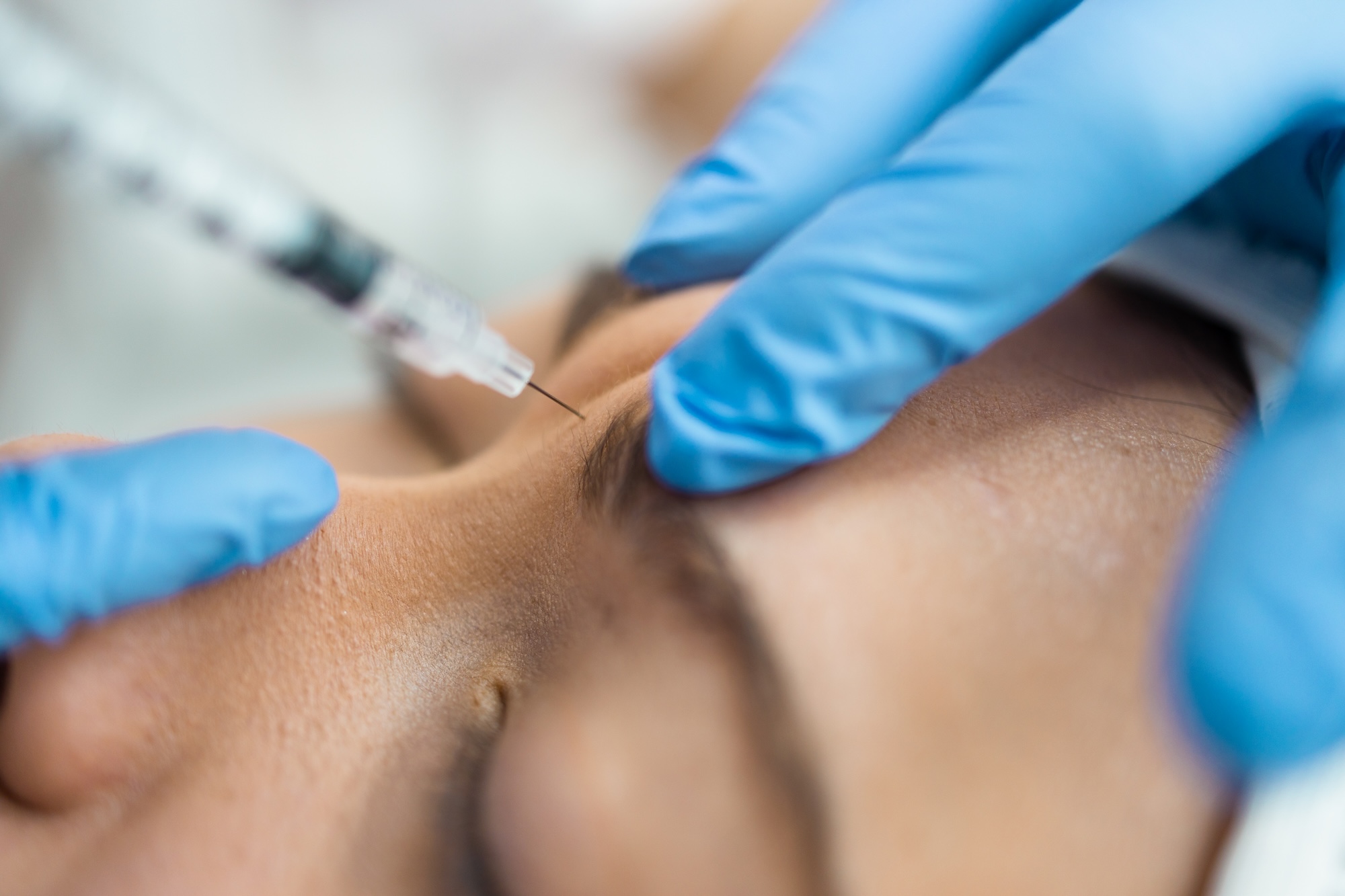 close-up image of woman at Vive Aesthetic and Wellness receiving Botox near Moorestown, NJ