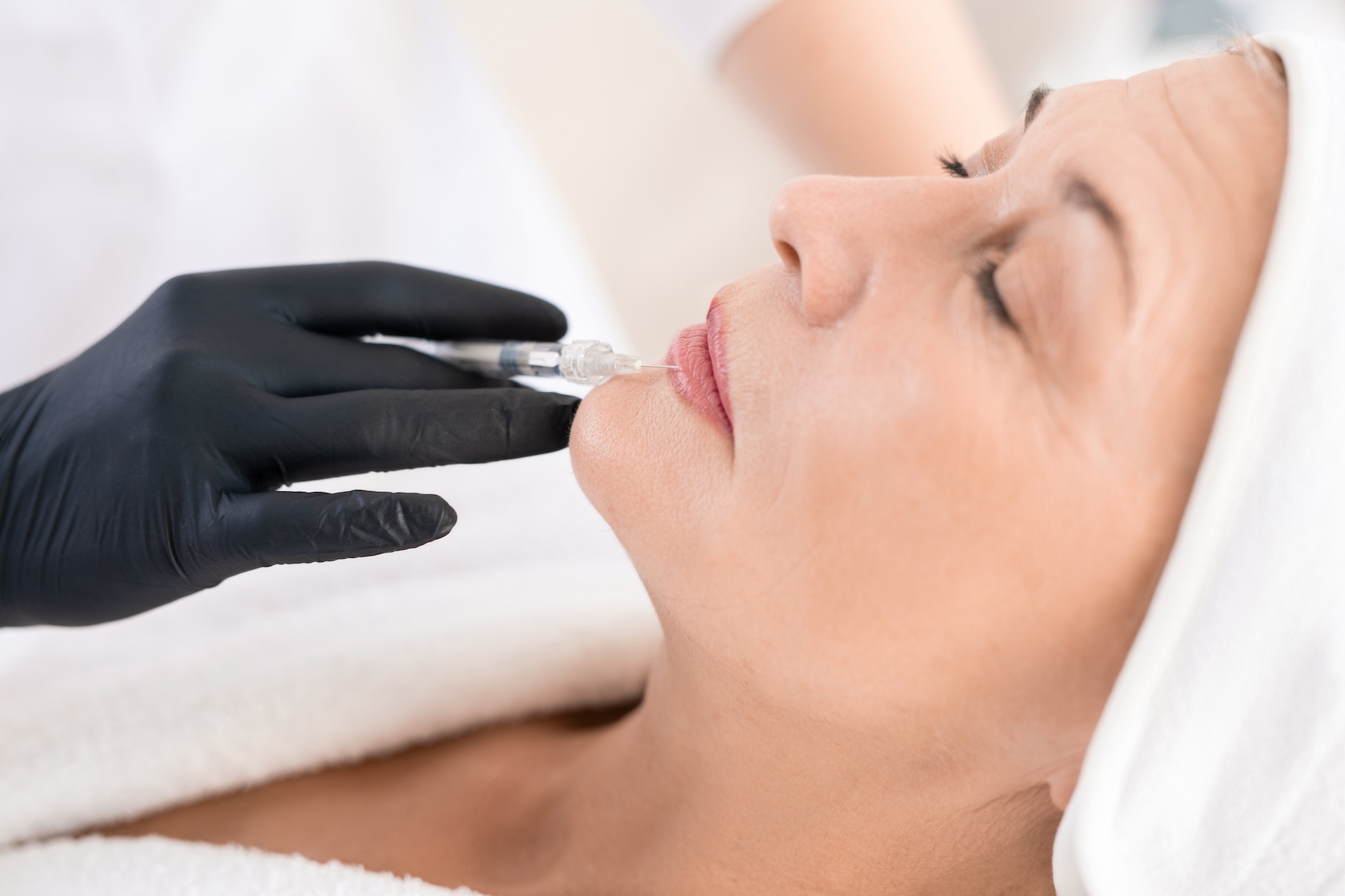 Older female patient at Vive Aesthetics & Wellness receiving lip filler near Medford, NJ from an expert provider.