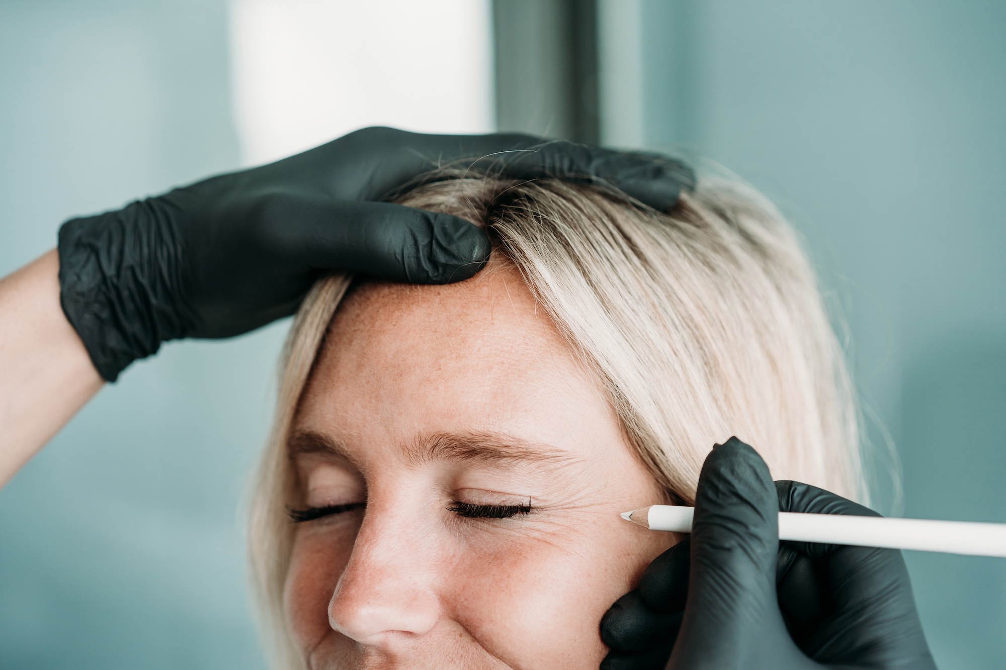A blonde woman at Vive Aesthetics & Wellness having her face marked with a white pencil where her provider will place her Botox injections near Medford, NJ.